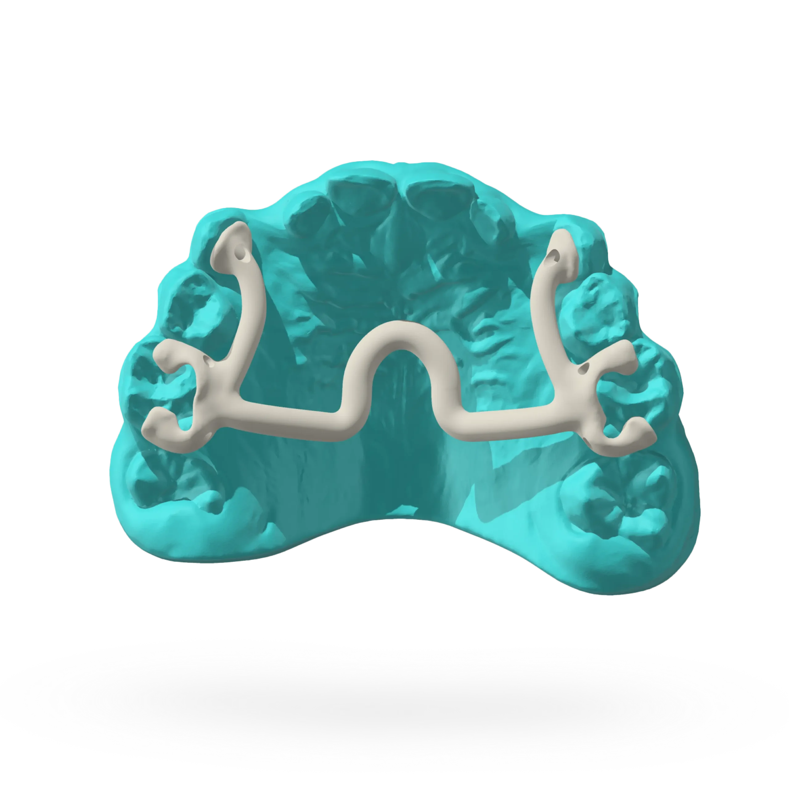 Zero Expander Dispositivo Ortodonzia Estense Ferrara (2)