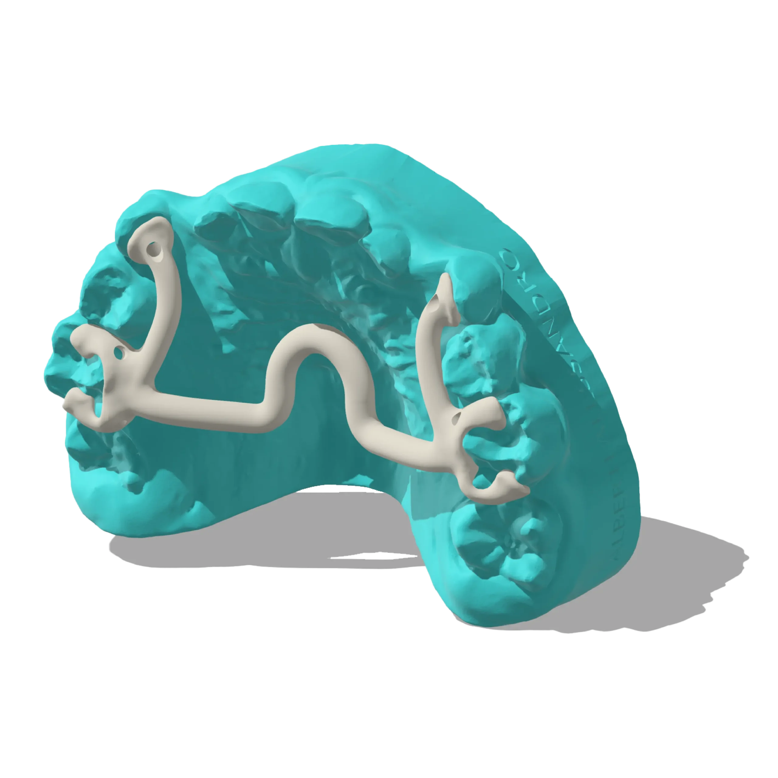 Zero Expander Dispositivo Ortodonzia Estense Ferrara (3)