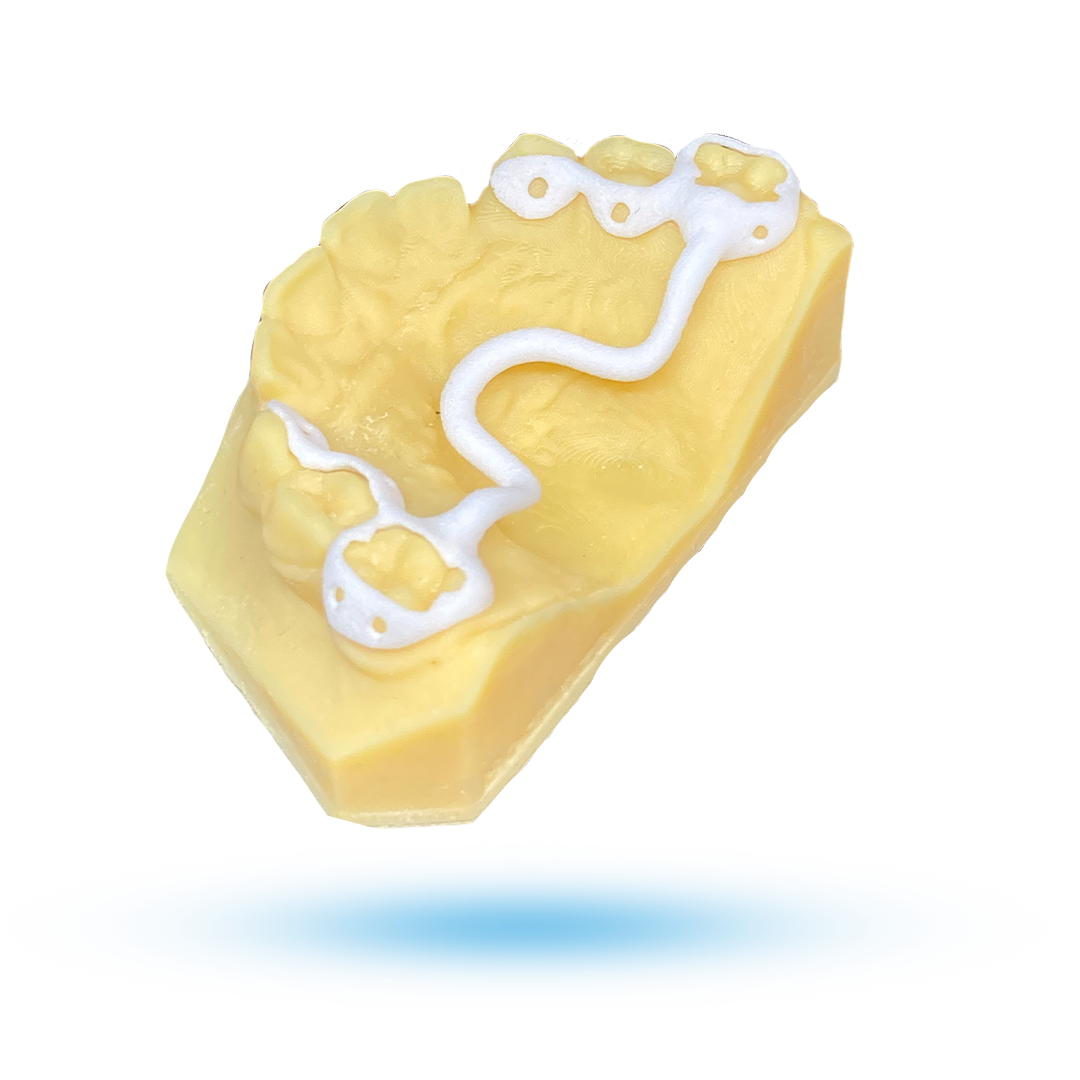Zero Expander Visual